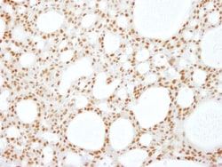 SCAF8/RBM16 Antibody, Novus Biologicals 0.1mL; Unlabeled:Antibodies, Polyclonal